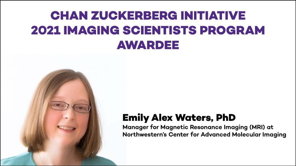 CAMI scientist Alex Waters receives 2021 CZI Imaging Scientist Fellowship